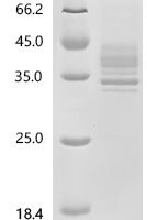 Human Tumor necrosis factor receptor superfamily member 13C (TNFRSF13C), partial Recombinant Protein, C-hFc1, aa 2–26 & E & 27–28 & 30–71 (H31S), Purity ≥95% - BioCrest Sci