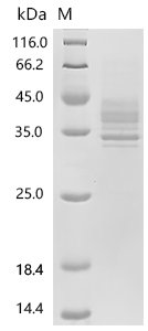 Human Tumor necrosis factor receptor superfamily member 13C (TNFRSF13C), partial Recombinant Protein, C-hFc1, aa 2–26 & E & 27–28 & 30–71 (H31S), Purity ≥95%, Homo sapiens (Human), Mammalian cell, C-terminal hFc1-tagged, 36.1 kDa, purity >≥ 95% as determined by SDS-PAGE.