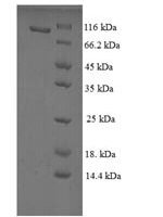 Rat Vitamin K-dependent protein S (Pros1) Recombinant Protein, N-GST - BioCrest Sci