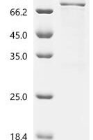 Human Complement factor H (CFH), partial Recombinant Protein, C-hFc1 - BioCrest Sci