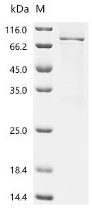 Human Complement factor H (CFH), partial Recombinant Protein, C-hFc1, Homo sapiens (Human), Mammalian cell, C-terminal hFc1-tagged, 77.9 kDa, purity >≥ 85% as determined by SDS-PAGE.