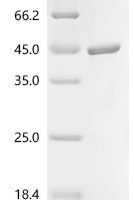 Vaccinia virus Envelope protein H3 (OPG108), partial Recombinant Protein, C-10His - BioCrest Sci