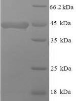 Mouse Macrosialin (Cd68), partial Recombinant Protein, N-His-SUMO - BioCrest Sci
