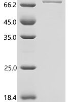 Human Nectin-2 (NECTIN2), partial Recombinant Protein, C-hFc1 - BioCrest Sci
