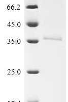 Human Retinaldehyde-binding protein 1 (RLBP1) Recombinant Protein - BioCrest Sci