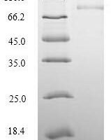 Human Desmoglein-3 (DSG3), partial Recombinant Protein, N-His-SUMO, aa 70–615 - BioCrest Sci