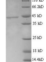 Human Tyrosine-protein kinase transmembrane receptor ROR1 (ROR1), partial Recombinant Protein - BioCrest Sci