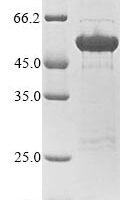 Human Neurofilament medium polypeptide (NEFM), partial Recombinant Protein, N-10His/C-Myc - BioCrest Sci