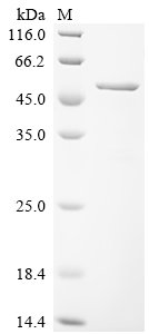 Human Paraneoplastic antigen Ma2 (PNMA2), partial Recombinant Protein, N-10His/C-Myc, Homo sapiens (Human), E.coli, N-terminal 10xHis-tagged and C-terminal Myc-tagged, 48.5 kDa, purity >≥ 90% as determined by SDS-PAGE.