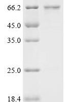 Human Probable RNA-binding protein 46 (RBM46) Recombinant Protein - BioCrest Sci