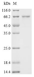 Human Probable RNA-binding protein 46 (RBM46) Recombinant Protein, Homo sapiens (Human), E.coli, C-terminal 6xHis-tagged, 66.9 kDa, purity >≥ 85% as determined by SDS-PAGE.