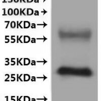 Human Olfactory receptor 51E2 (OR51E2)-VLPs Recombinant Protein - BioCrest Sci