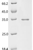 Human A disintegrin and metalloproteinase with thrombospondin motifs 2 (ADAMTS2), partial Recombinant Protein - BioCrest Sci