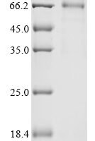 Human Protein IL-40 (C17orf99) Recombinant Protein, C-hFc1 - BioCrest Sci