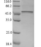Human CD40 ligand (CD40LG), partial Recombinant Protein, N-GST - BioCrest Sci