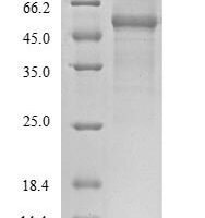 Severe acute respiratory syndrome coronavirus 2 Nucleoprotein (N) Recombinant Protein, Tag-Free - BioCrest Sci