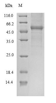 Severe acute respiratory syndrome coronavirus 2 Nucleoprotein (N) Recombinant Protein, Tag-Free, Severe acute respiratory syndrome coronavirus 2 (2019-nCoV) (SARS-CoV-2), Mammalian cell, Tag-Free, 47 kDa, purity >≥ 85% as determined by SDS-PAGE.
