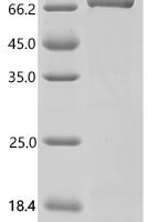 Human AP-1 complex subunit beta-1 (AP1B1), partial Recombinant Protein - BioCrest Sci
