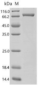 Human AP-1 complex subunit beta-1 (AP1B1), partial Recombinant Protein, E.coli, C-terminal 6xHis-tagged, 72.8 kDa, purity >≥ 85% as determined by SDS-PAGE.