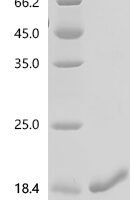 Rat Natriuretic peptides B (Nppb), partial Recombinant Protein, C-His, aa 27–102 - BioCrest Sci