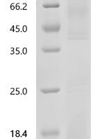 Human Erythroferrone (ERFE), partial Recombinant Protein, C-His - BioCrest Sci