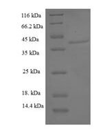 Human Aspartyl/asparaginyl beta-hydroxylase (ASPH), partial Recombinant Protein, N-His-SUMO - BioCrest Sci