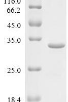 Mouse Nucleoplasmin-3 (Npm3) Recombinant Protein - BioCrest Sci