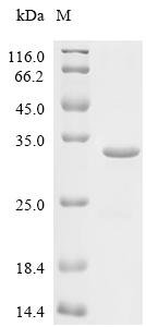 Mouse Nucleoplasmin-3 (Npm3) Recombinant Protein, Mus musculus (Mouse), E.coli, C-terminal 6xHis-tagged, 25.8 kDa, purity >≥ 85% as determined by SDS-PAGE.