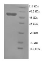 Mouse Mesothelin (Msln), partial Recombinant Protein, N-His-SUMO, Mus musculus (Mouse), E.coli, N-terminal 6xHis-SUMO-tagged, 50.1 kDa, purity >≥ 90% as determined by SDS-PAGE.