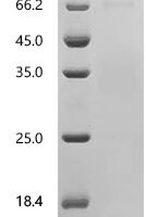 Human Neogenin (NEO1), partial Recombinant Protein - BioCrest Sci