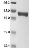 Escherichia coli Glycine betaine/proline betaine-binding periplasmic protein (proX) Recombinant Protein - BioCrest Sci