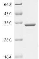 Rabbit Beta-crystallin B2 (CRYBB2) Recombinant Protein - BioCrest Sci