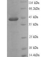 Mouse Plasminogen activator inhibitor 1 (Serpine1) Recombinant Protein, N-His - BioCrest Sci