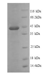 Mouse Plasminogen activator inhibitor 1 (Serpine1) Recombinant Protein, N-His, Mus musculus (Mouse), Yeast, N-terminal 6xHis-tagged, 44.9 kDa, purity >≥ 90% as determined by SDS-PAGE.