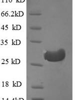 Human Cathepsin F (CTSF), partial Recombinant Protein - BioCrest Sci