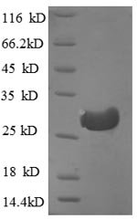 Human Cathepsin F (CTSF), partial Recombinant Protein, Homo sapiens (Human), E.coli, N-terminal 6xHis-tagged, 30.3 kDa, purity >≥ 90% as determined by SDS-PAGE.