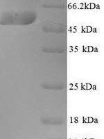 Human Kynurenine 3-monooxygenase (KMO) Recombinant Protein, N-His, aa 1–486, Yeast - BioCrest Sci