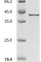 Human Charged multivesicular body protein 4b (CHMP4B) Recombinant Protein, C-His - BioCrest Sci