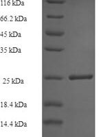 Human Tubulinyl-Tyr carboxypeptidase 1 (VASH1) Recombinant Protein - BioCrest Sci