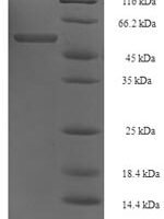 Acinetobacter baumannii Elongation factor Tu (tuf1) Recombinant Protein - BioCrest Sci