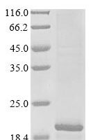 Human DET1- and DDB1-associated protein 1 (DDA1) Recombinant Protein - BioCrest Sci