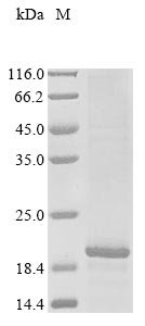 Human DET1- and DDB1-associated protein 1 (DDA1) Recombinant Protein, Homo sapiens (Human), E.coli, N-terminal 10xHis-tagged, 17.7 kDa, purity >≥ 85% as determined by SDS-PAGE.