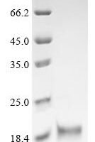 Chicken Fibroblast growth factor 2 (FGF2) Recombinant Protein, N-His - BioCrest Sci