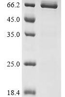 Xenopus laevis Bic-C protein (Bic-C) (H140A,S141A), partial Recombinant Protein - BioCrest Sci