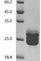 Aspergillus niger Probable endo-1,4-beta-xylanase B (xlnB) Recombinant Protein, C-His-Myc - BioCrest Sci