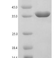 Human Galectin-9 (LGALS9) Recombinant Protein, N-His - BioCrest Sci