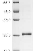 Human Interleukin-21 (IL21), partial Recombinant Protein, C-His, aa 30–162, E.coli - BioCrest Sci