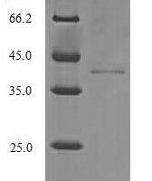 Human Pterin-4-alpha-carbinolamine dehydratase (PCBD1) Recombinant Protein - BioCrest Sci