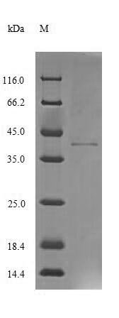 Human Pterin-4-alpha-carbinolamine dehydratase (PCBD1) Recombinant Protein, Homo sapiens (Human), E.coli, N-terminal 6xHis-GST-tagged, 41.9 kDa, purity >≥ 85% as determined by SDS-PAGE.