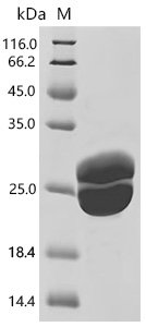 Human Titin (TTN),partial Recombinant Protein, Yeast, C-terminal 6xHis-tagged, 22.6 kDa, purity >≥ 85% as determined by SDS-PAGE.